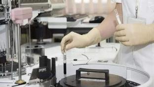 Tratamento com c�lulas CAR-T para leucemia e linfomas pode chegar ao SUS em dois anos