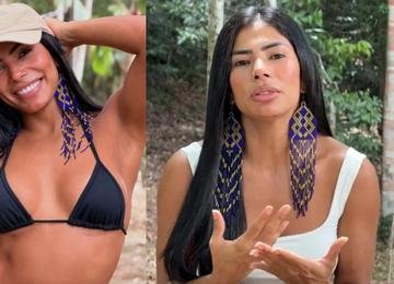 Ex-BBB Marciele se desespera ao perceber 'careca grande' e relata alopecia