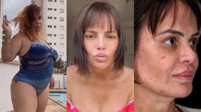 Valentina Francavilla perde 40 kg e faz procedimentos no rosto; veja vídeo